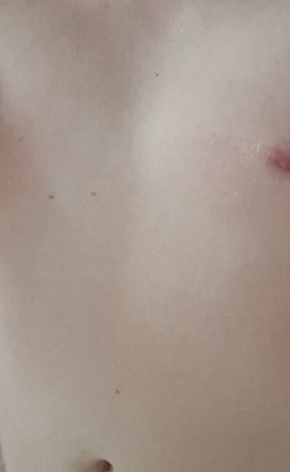 Longus_
