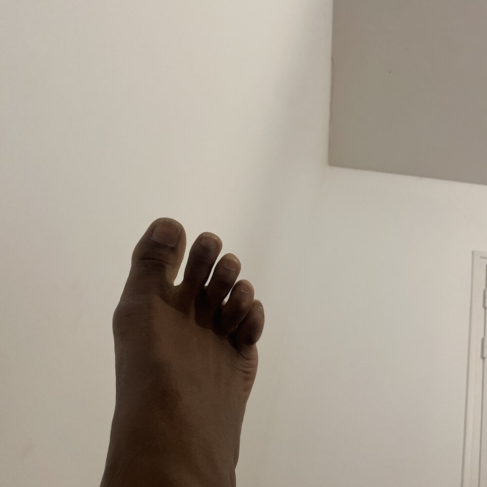 blackbite99