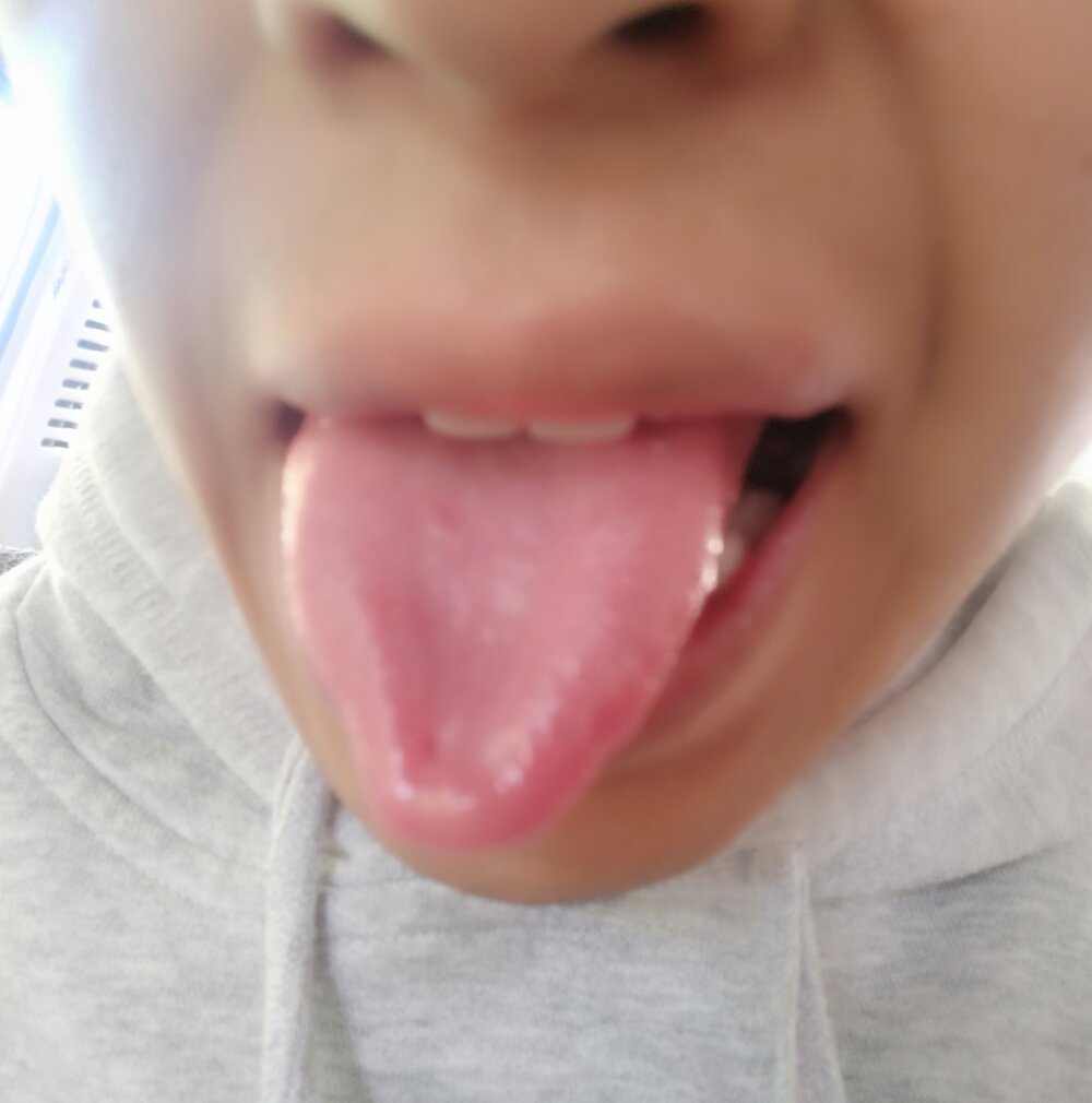 oosiip